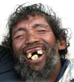 Dentadura.jpg