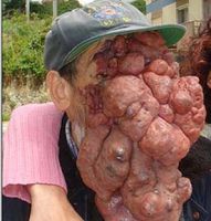 Deforme12.jpg